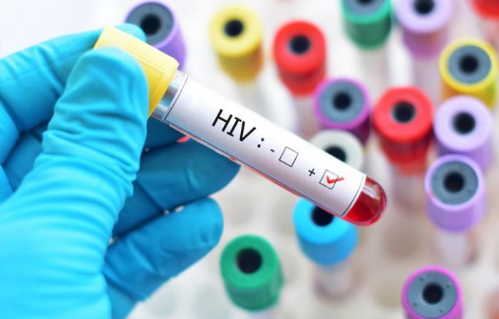 Finally! Cure For HIV Has Been Discovered