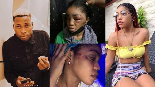 Davido's DMW artist, Lil Frosh Beats Girlfriend To A Pulp (See Photos)
