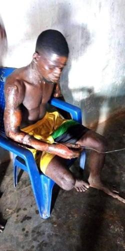 Lady sets husband ablaze in Benue state