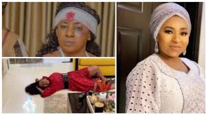 Fans worry as Mide Martins sustains head injury