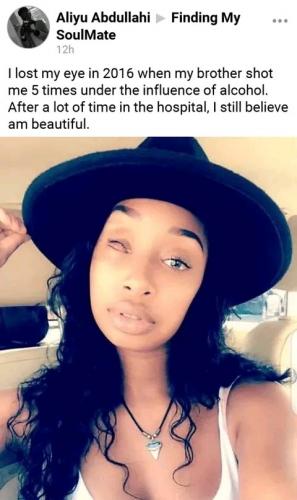 Lady explains the reason she lost her eye, says "I'm still beautiful"